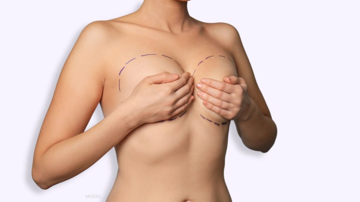 Woman was just FIFTEEN when she had her breast reduction