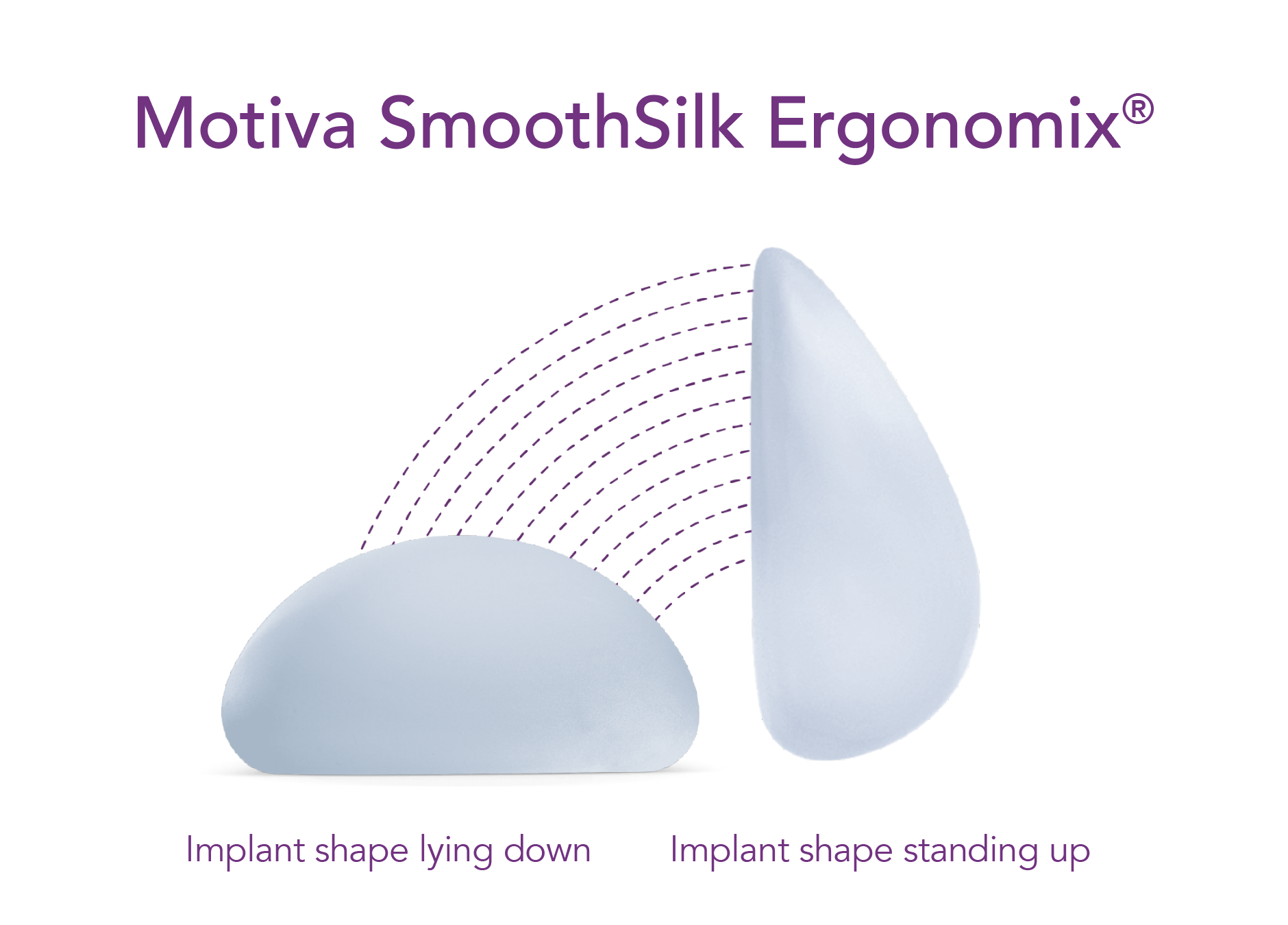 Erica Morpheus8 1 breast implant diagram