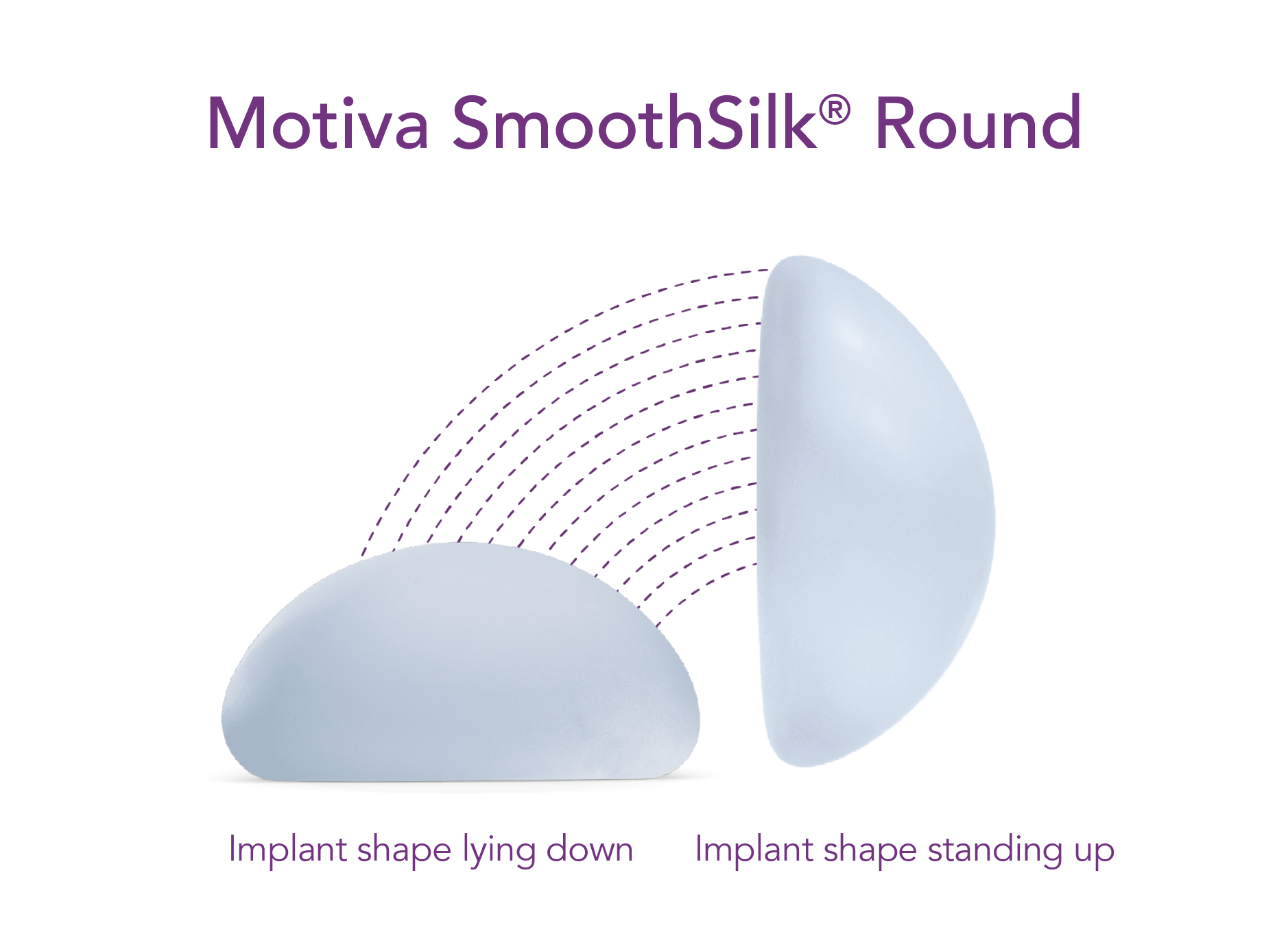 Motiva-SmoothSilk-Round breast implant diagram